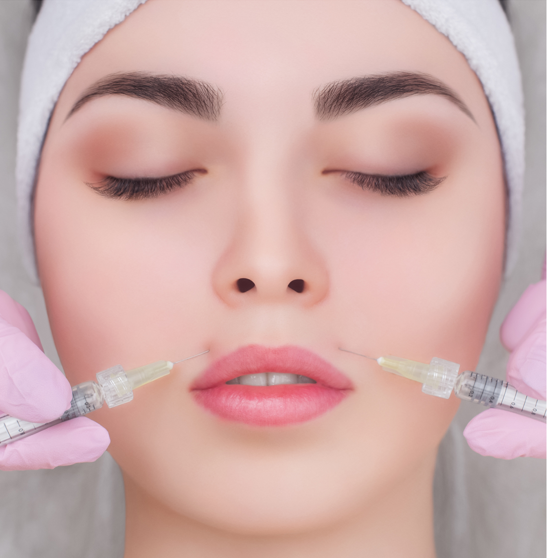 Woman with two syringes going into her skin near her top lip.
