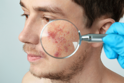 Individual with magnifying glass on top of their cheek.